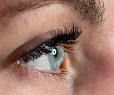 Keratoconus Treatment