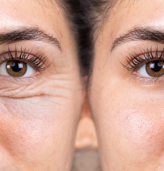 Ocular Cosmetology Assessment