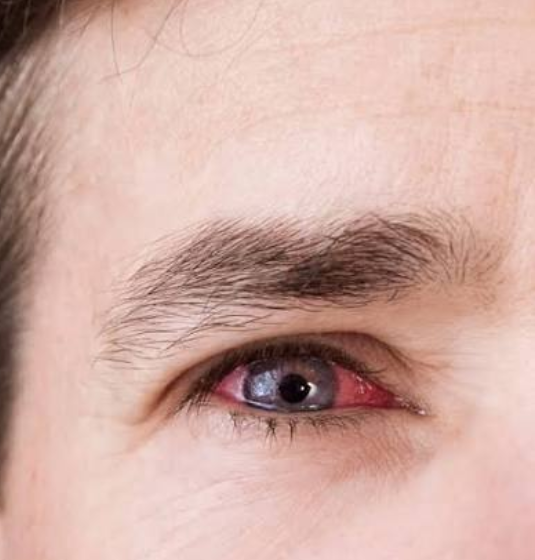 Vitreo-retina Examination